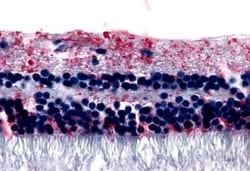 Invitrogen mGluR6 Polyclonal Antibody 50 &mu;g; Unconjugated:Antibodies,