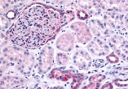 Invitrogen INPP5J Polyclonal Antibody 50 &mu;g; Unconjugated:Antibodies,