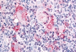 Invitrogen ITGA2 Polyclonal Antibody 50 &mu;g; Unconjugated:Antibodies,
