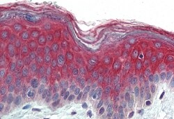 Invitrogen ITGA3 Polyclonal Antibody 50 &mu;g; Unconjugated:Antibodies,