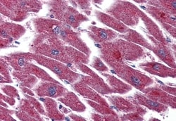 Invitrogen LPAR3 Polyclonal Antibody 50 &mu;g; Unconjugated:Antibodies,