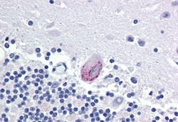 Invitrogen LPCAT1 Polyclonal Antibody 50 &mu;g; Unconjugated:Antibodies,