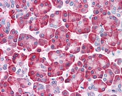 Invitrogen LRRN4 Polyclonal Antibody 50 &mu;g | Buy Online | Invitrogen&trade; | Fisher Scientific