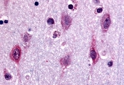 Invitrogen ERK1 Polyclonal Antibody 50 &mu;g; Unconjugated:Antibodies,