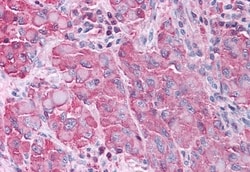 Invitrogen ERK1 Polyclonal Antibody 50 &mu;g; Unconjugated:Antibodies,