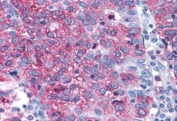 Invitrogen ERK1 Polyclonal Antibody 50 &mu;g; Unconjugated:Antibodies,