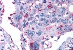 Invitrogen ERK1 Polyclonal Antibody 50 &mu;g; Unconjugated:Antibodies,