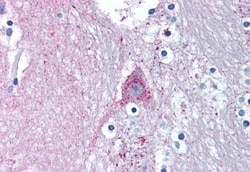 Invitrogen MARK1 Polyclonal Antibody 50 &mu;g; Unconjugated:Antibodies,