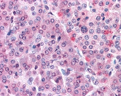 Invitrogen MLEC Polyclonal Antibody 50 &mu;g; Unconjugated:Antibodies,