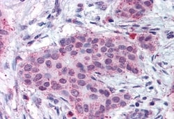Invitrogen MMP13 Polyclonal Antibody 50 &mu;g; Unconjugated:Antibodies,