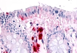 Invitrogen RON Polyclonal Antibody 50 &mu;g; Unconjugated:Antibodies, Polyclonal