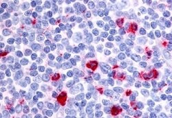 Invitrogen RON Polyclonal Antibody 50 &mu;g; Unconjugated:Antibodies, Polyclonal