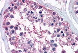 Invitrogen NR0B1 Polyclonal Antibody 50 μg; Unconjugated:Antibodies,