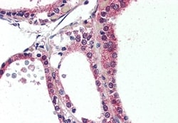 Invitrogen NR1D2 Polyclonal Antibody 50 &mu;g; Unconjugated:Antibodies,