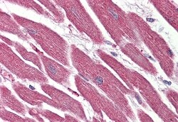 Invitrogen NR1D2 Polyclonal Antibody 50 &mu;g; Unconjugated:Antibodies,