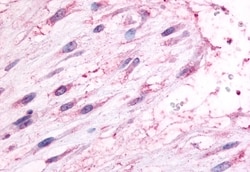 Invitrogen Oxytocin Receptor Polyclonal Antibody 50 μg; Unconjugated:Antibodies,