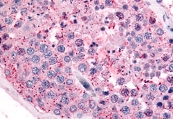 Invitrogen PAK6 Polyclonal Antibody 50 &mu;g; Unconjugated:Antibodies,