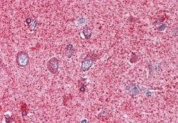Invitrogen PAK7 Polyclonal Antibody 50 &mu;g; Unconjugated:Antibodies,