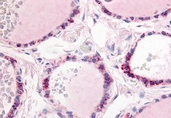 Invitrogen PDE1C Polyclonal Antibody 50 &mu;g; Unconjugated:Antibodies,