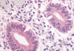 Invitrogen PDE3A Polyclonal Antibody 50 &mu;g; Unconjugated:Antibodies,