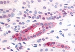 Invitrogen PDGFRB Polyclonal Antibody 50 &mu;g; Unconjugated:Antibodies,