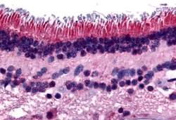 Invitrogen PTPRM Polyclonal Antibody 50 &mu;g | Buy Online | Invitrogen&trade; | Fisher Scientific