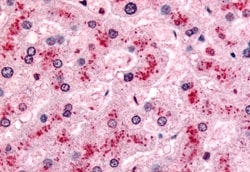 Invitrogen PYGL Polyclonal Antibody 50 &mu;g; Unconjugated:Antibodies,