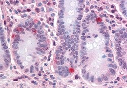 Invitrogen SEMA4B Polyclonal Antibody 50 &mu;g; Unconjugated:Antibodies,
