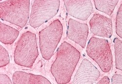 Invitrogen SEMA4B Polyclonal Antibody 50 &mu;g; Unconjugated:Antibodies,