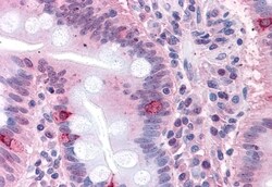 SEMA4B Polyclonal Antibody:Antibodies, Polyclonal