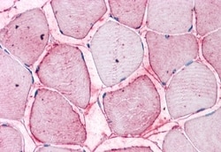 SEMA4B Polyclonal Antibody:Antibodies, Polyclonal