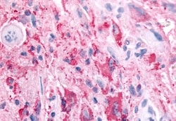 SGK2 Polyclonal Antibody:Antibodies, Polyclonal