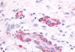 SGK2 Polyclonal Antibody:Antibodies, Polyclonal