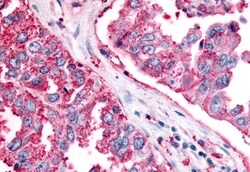 SGK2 Polyclonal Antibody:Antibodies, Polyclonal