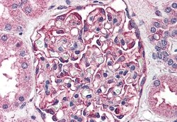 SGK2 Polyclonal Antibody:Antibodies, Polyclonal