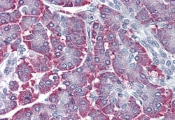 SGK2 Polyclonal Antibody:Antibodies, Polyclonal