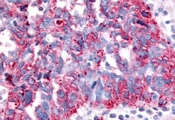 SGK2 Polyclonal Antibody:Antibodies, Polyclonal