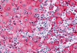 SGK2 Polyclonal Antibody:Antibodies, Polyclonal