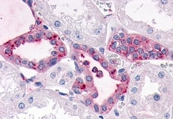 Invitrogen SGK3 Polyclonal Antibody 50 &mu;g; Unconjugated:Antibodies,