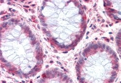 SLC1A4 Polyclonal Antibody:Antibodies, Polyclonal