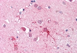 SLC1A4 Polyclonal Antibody:Antibodies, Polyclonal