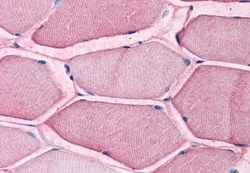 Invitrogen ASCT2 Polyclonal Antibody 50 &mu;g; Unconjugated:Antibodies,