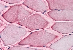 Invitrogen ASCT2 Polyclonal Antibody 50 &mu;g; Unconjugated:Antibodies,