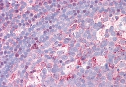 Invitrogen CTR1 Polyclonal Antibody 50 &mu;g; Unconjugated:Anticuerpos