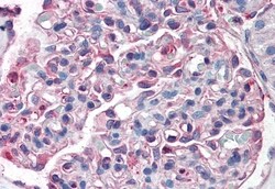 Invitrogen ZIP14 Polyclonal Antibody 50 &mu;g; Unconjugated:Antibodies,