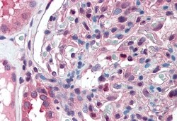 ZIP14 Polyclonal Antibody:Antibodies, Polyclonal