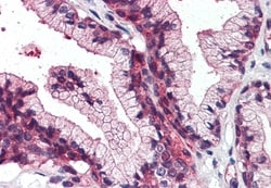ZIP14 Polyclonal Antibody:Antibodies, Polyclonal
