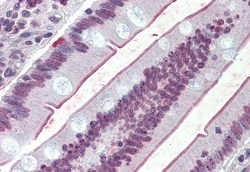 SGLT1 Polyclonal Antibody, Invitrogen 50 &mu;g; Unconjugated:Antibodies,