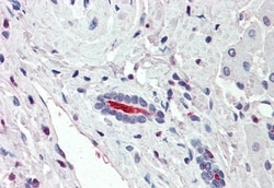 SGLT1 Polyclonal Antibody, Invitrogen 50 &mu;g; Unconjugated:Antibodies,