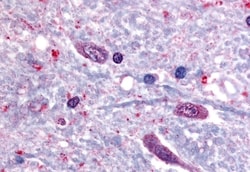 SLC5A3 Polyclonal Antibody:Antibodies, Polyclonal